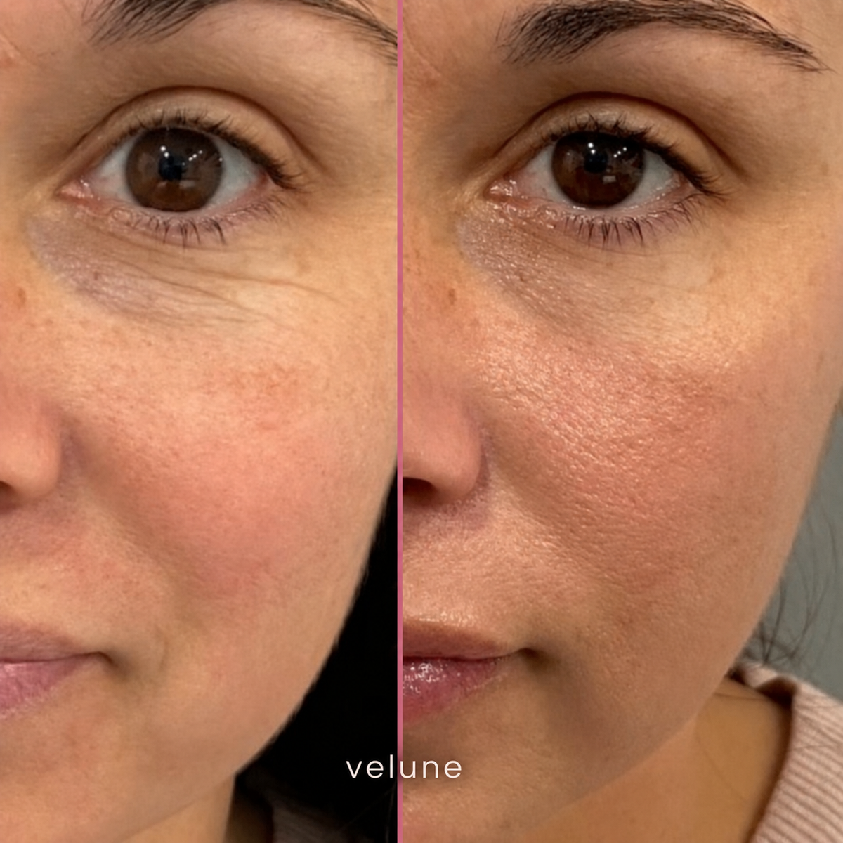 Velune | 100% Volufline Under-Eye Serum