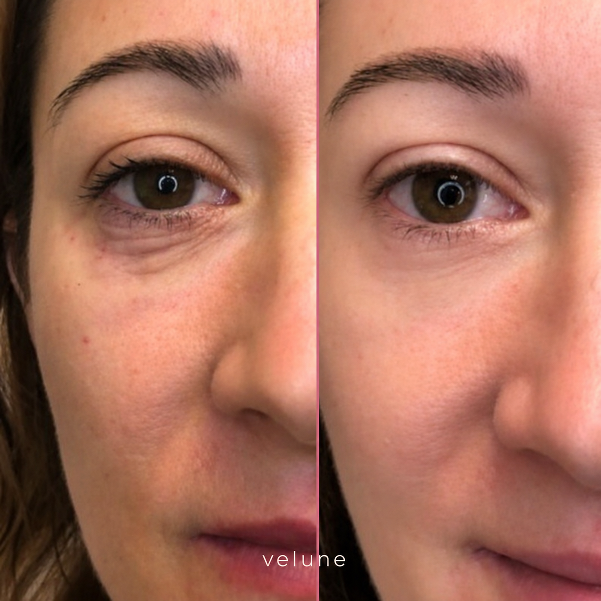 Velune | 100% Volufline Under-Eye Serum