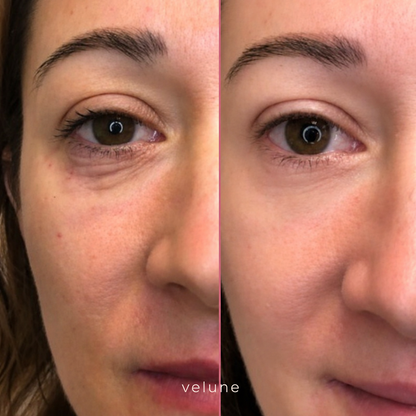 Velune | 100% Volufline Under-Eye Serum